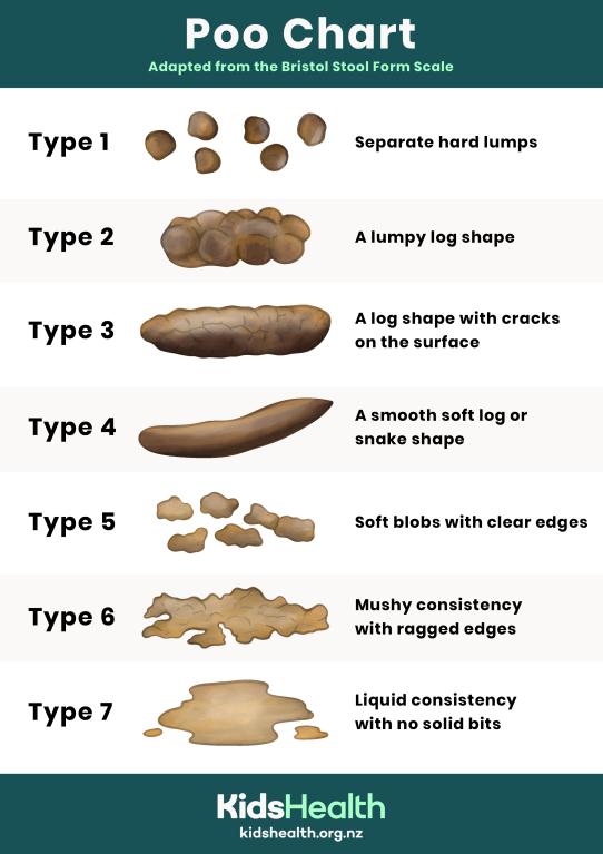 Adaption of a bristol stool chart showing the different types of stools with type and description.