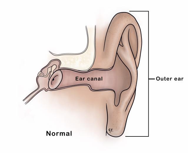 Illustration of a child's normal outer ear