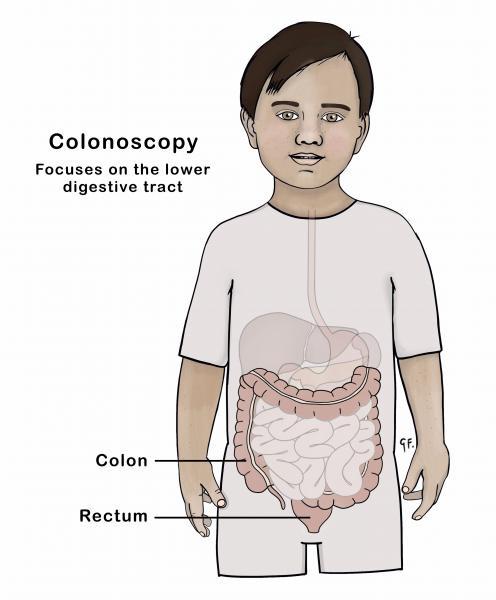 Illustration showing lower digestive tract anatomy