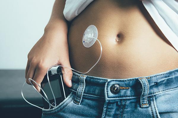 Young person with an insulin pump attached to their belly