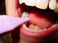 Photo showing a thermometer in a child's mouth 