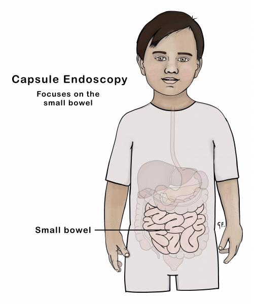 Illustration showing anatomy of the digestive tract that is assessed via capsule endoscopy