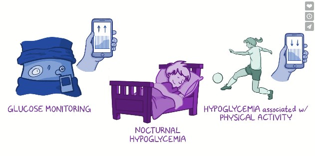 Graphic showing the association of hypoglycaemia and physical activity