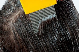 Wet Combing With Conditioner For Treating Head Lice Kidshealth Nz