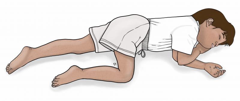 Illustration of a child in the recovery position