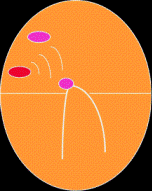 Diagrama mostrando taquicardia atrial