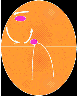 Diagrama mostrando tremores atriais